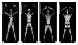 Full Body Scanners